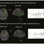 White matter tract-specific alterations in male patients with untreated obstructive sleep apnea are associated with worse cognitive function (Impact factor(JCR 2018) : 4.571)